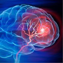 Cerebrovascular Diseases and Stroke Symposium course page icon of brain